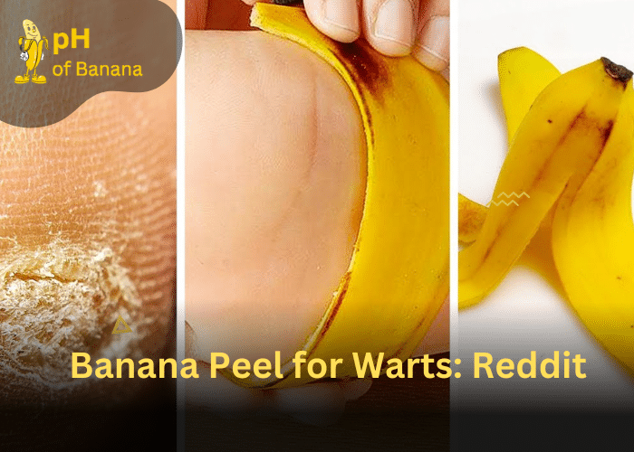 Banana Peel for Warts: Can Banana Peel Remove Warts?
